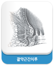 괄약근간치루