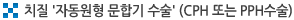 치질 '자동원형 문합기 수술' (CPH 또는 PPH수술)